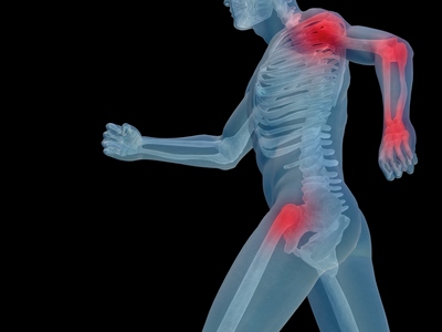 osteoporoza tratamente si remedii