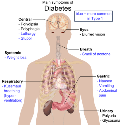 diabetul zaharat de tip 2